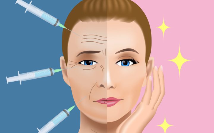 tratament cu botox pentru riduri