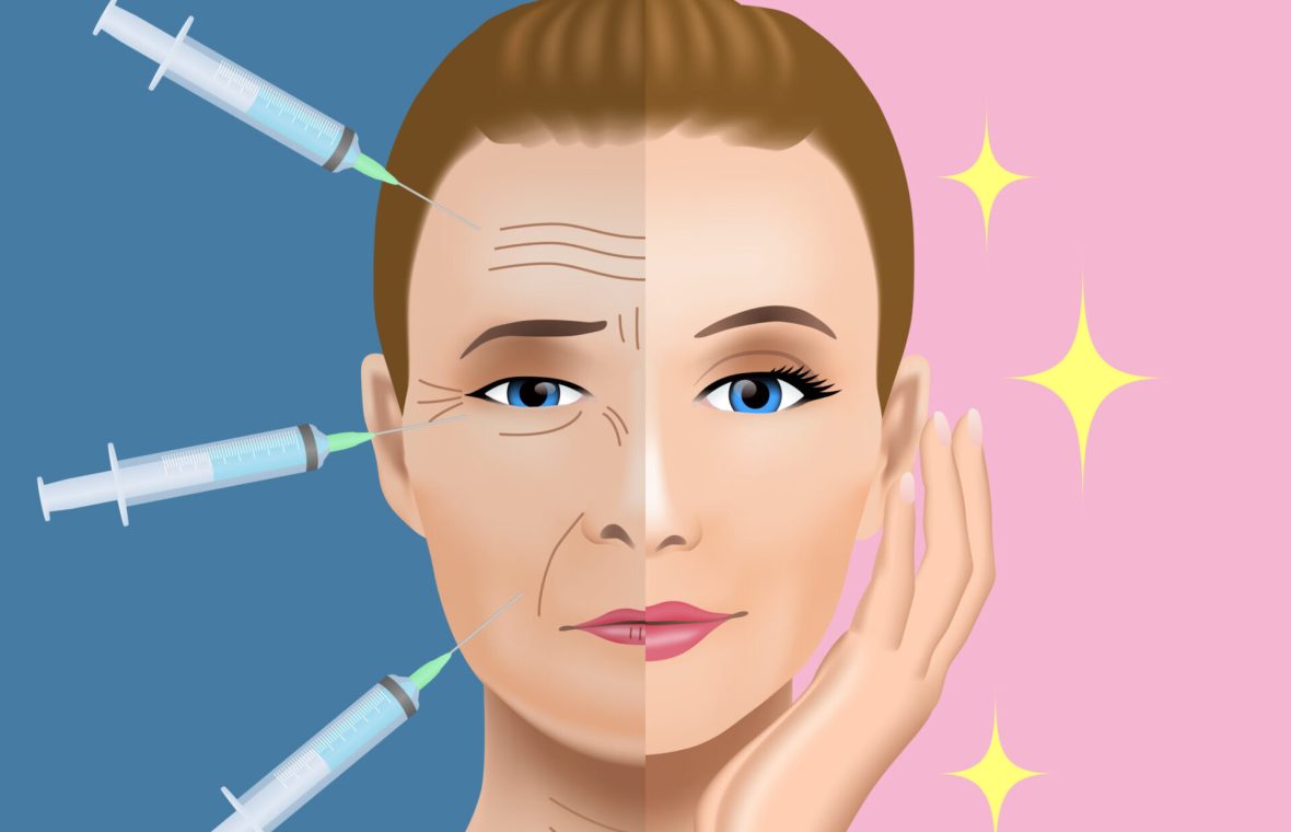 tratament cu botox pentru riduri