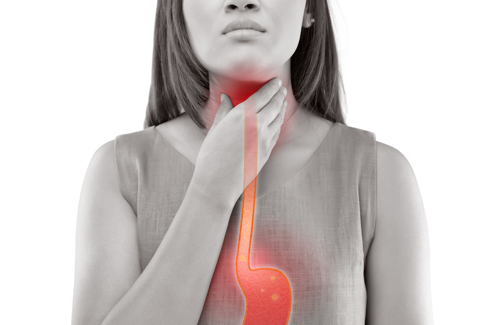 refluxul gastroesofagian
