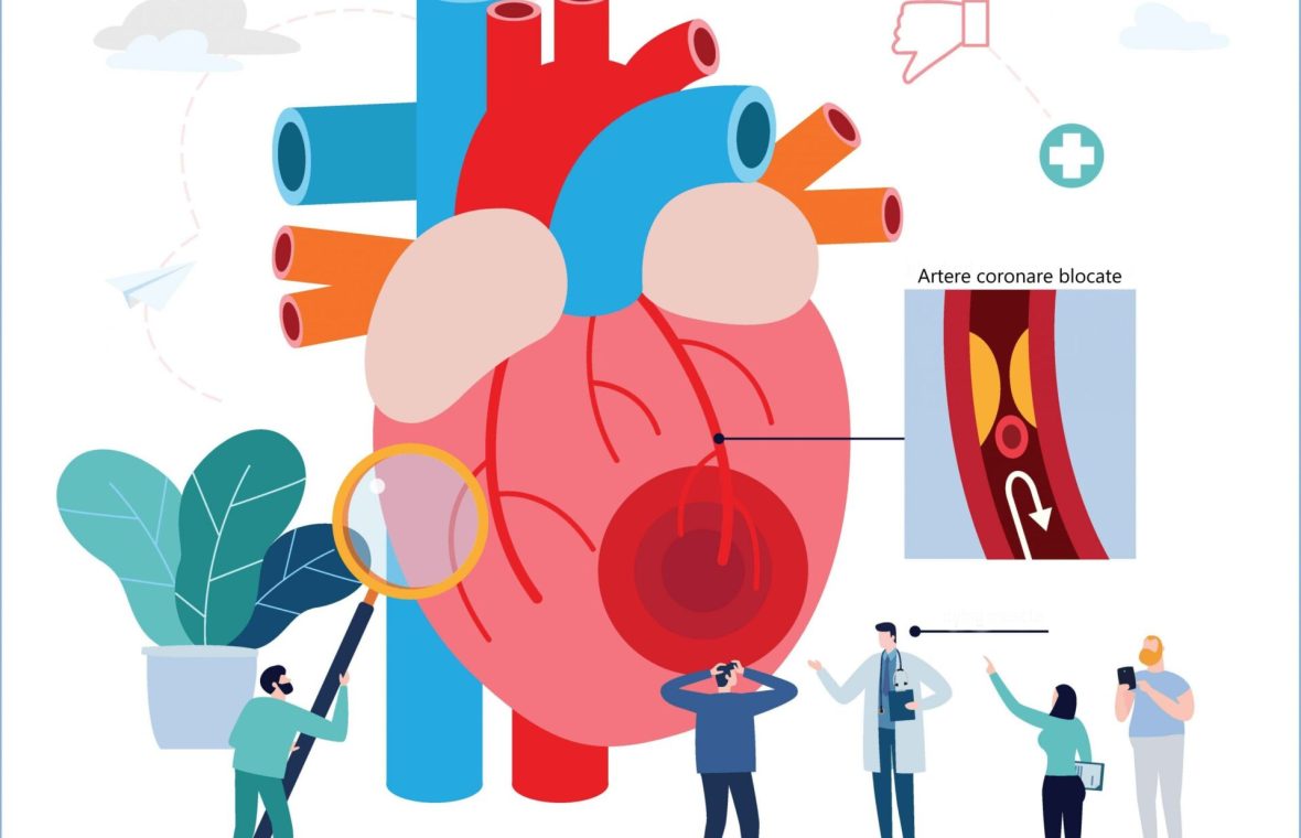 Ateroscleroza reprezintă cea mai importantă cauză de mortalitate. Foto: Shutterstock