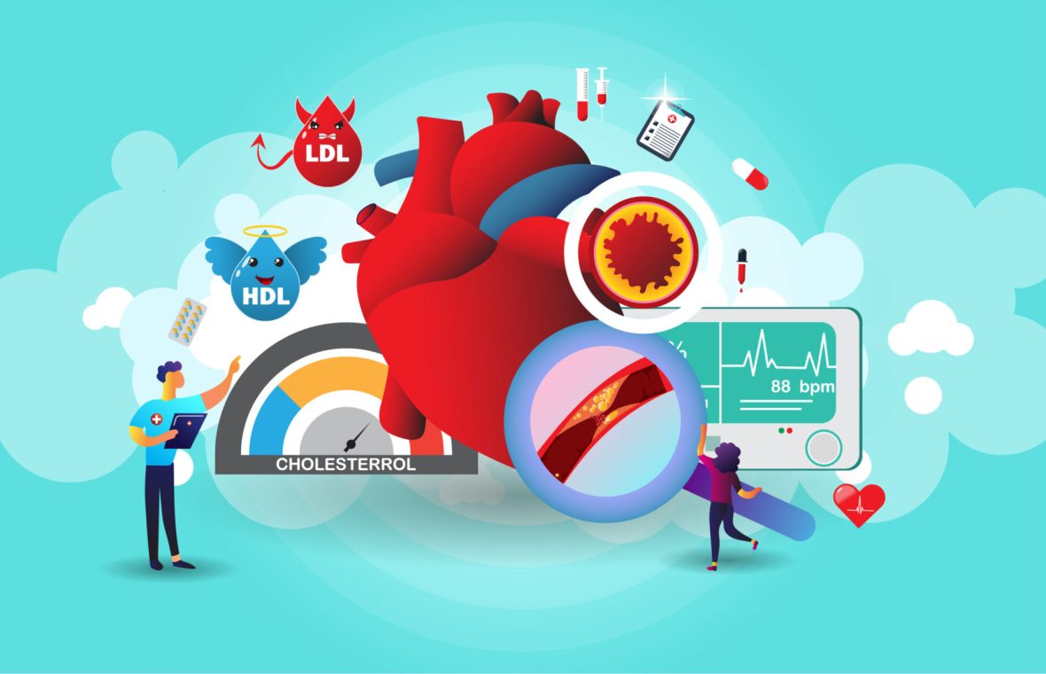 Studiile recente au demonstrat că există o relație directă între colesterol și morbiditatea și mortalitatea cardiovasculară.