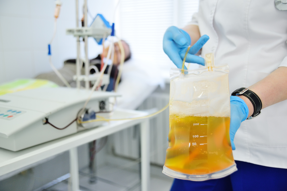 plasmă COVID-19