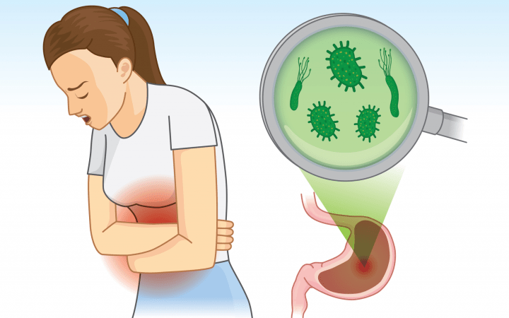 Răceala intestinelor este termenul popular, nemedical pentru diagnosticul de gastroenterită acută.