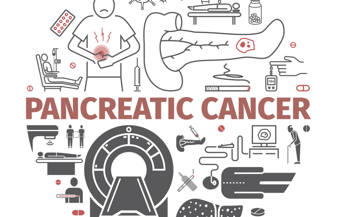 Durerea de pancreas apare inclusiv in fazele avansate de cancer pancreatic