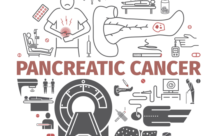 Durerea de pancreas apare inclusiv in fazele avansate de cancer pancreatic
