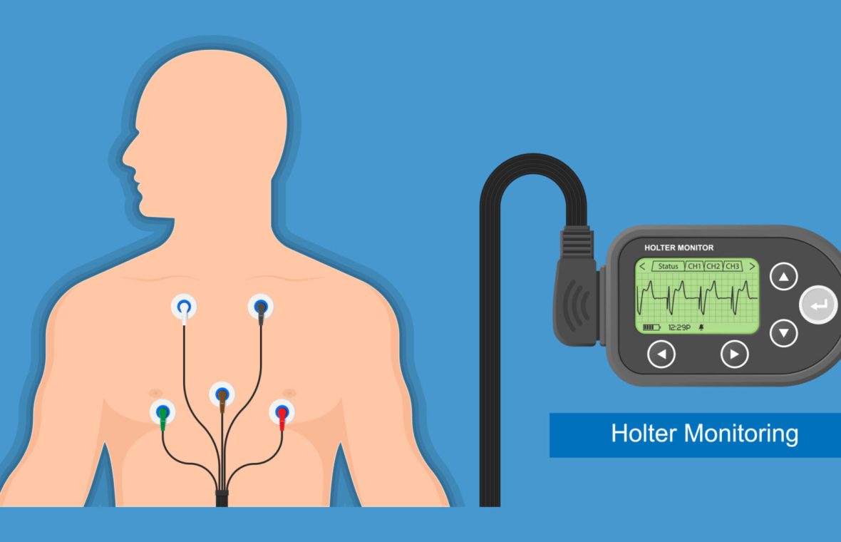 Ghidul de hipertensiune arterială recomandă ca în cazul în care se identifică o tensiune arterială de 140/90 mmHg sau mai mult, pacientul să fie supus unei verificări ale tensiunii arteriale acasă și în timpul activităților de zi cu zi.