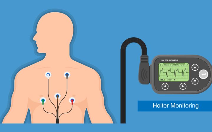 Ghidul de hipertensiune arterială recomandă ca în cazul în care se identifică o tensiune arterială de 140/90 mmHg sau mai mult, pacientul să fie supus unei verificări ale tensiunii arteriale acasă și în timpul activităților de zi cu zi.
