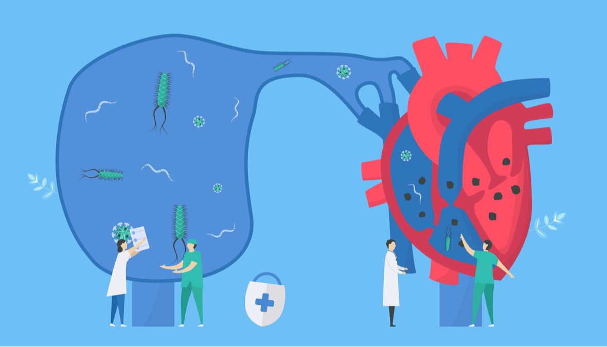 simptome endocardita tratament. Ilustratie cu o inima infectata cu microorganisme si o echipa medicala care o trateaza