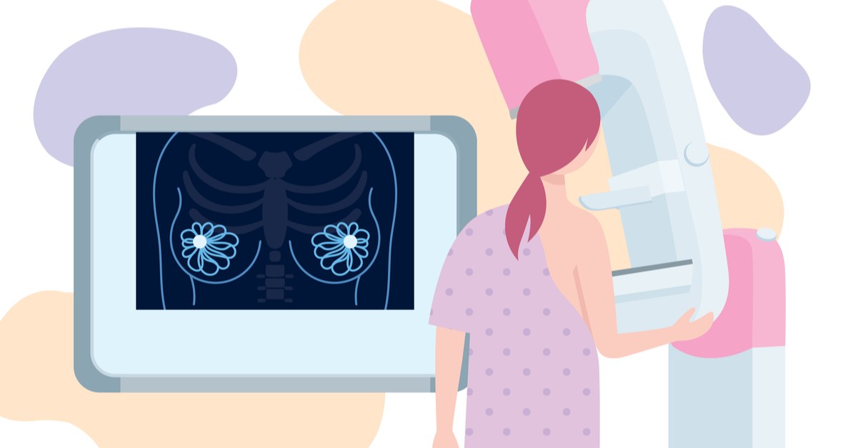 analize medicale femei peste 50 de ani. femeie care face o mamografie