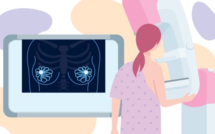 analize medicale femei peste 50 de ani. femeie care face o mamografie