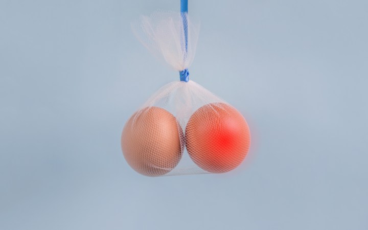 cancer testicular cauze simptome tratament. doua oua intr-o punga transparenta semnificand testiculele in scrot
