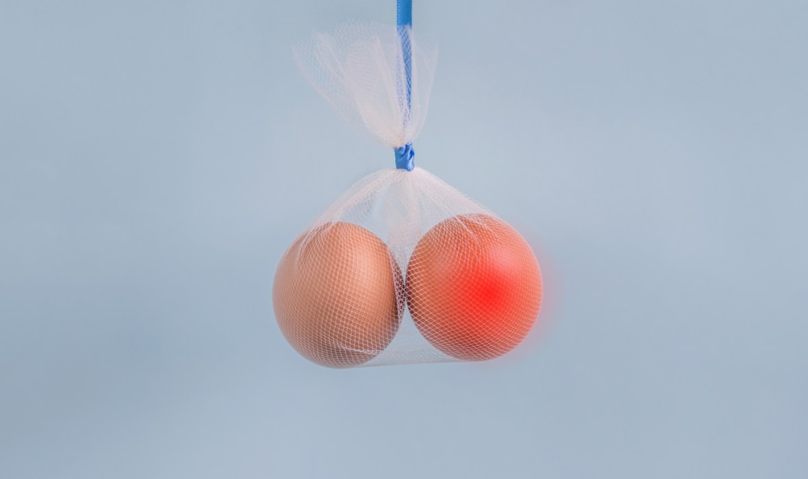 cancer testicular cauze simptome tratament. doua oua intr-o punga transparenta semnificand testiculele in scrot