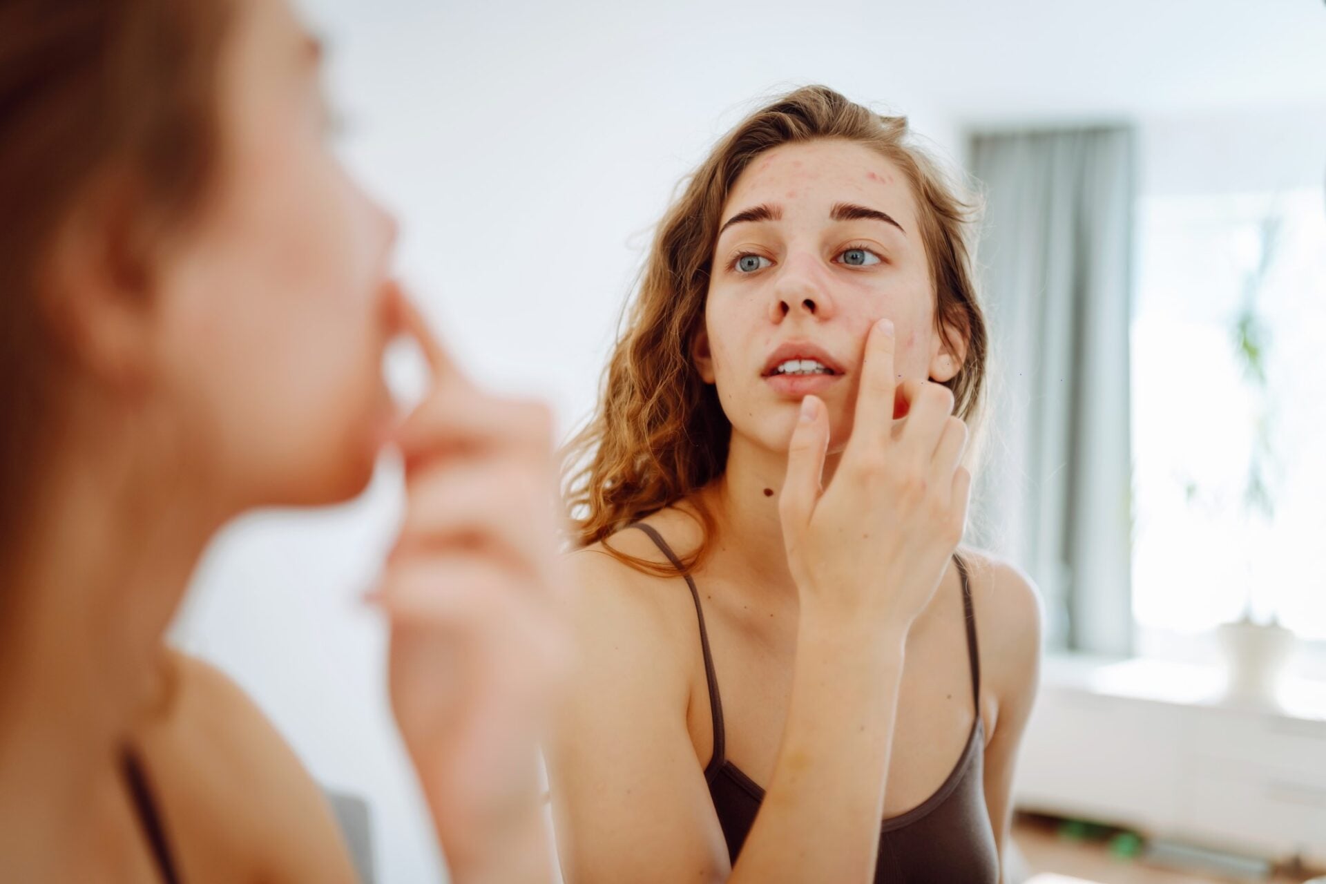 femeie care se uită în oglindă și analizează semne pe piele care ar putea semnala debutul cancerului de piele