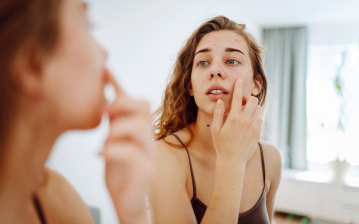 femeie care se uită în oglindă și analizează semne pe piele care ar putea semnala debutul cancerului de piele