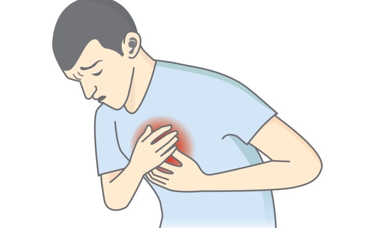 miocardita vaccinuri COVID-19