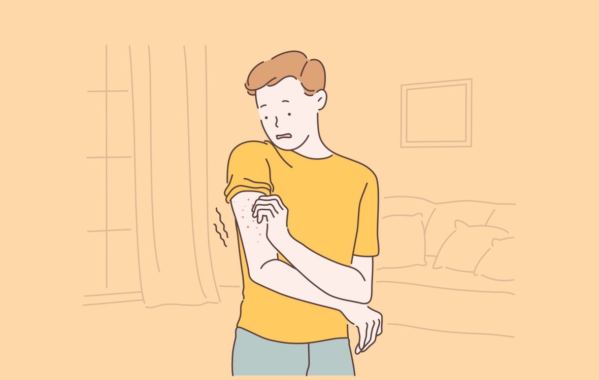 eczema tipuri factori declansatori si tratament eficient. barbat cu eczema pe brat care se scarpina