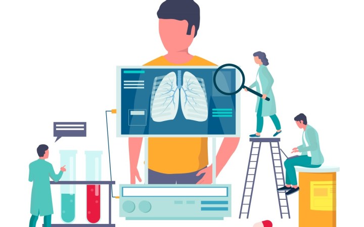 sarcoidoza cum se manifesta si ce tratamente exista. barbat la radiografie pulmonara