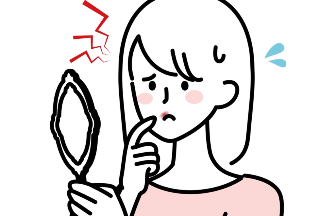 herpes oral cauze simptome tratament si remedii