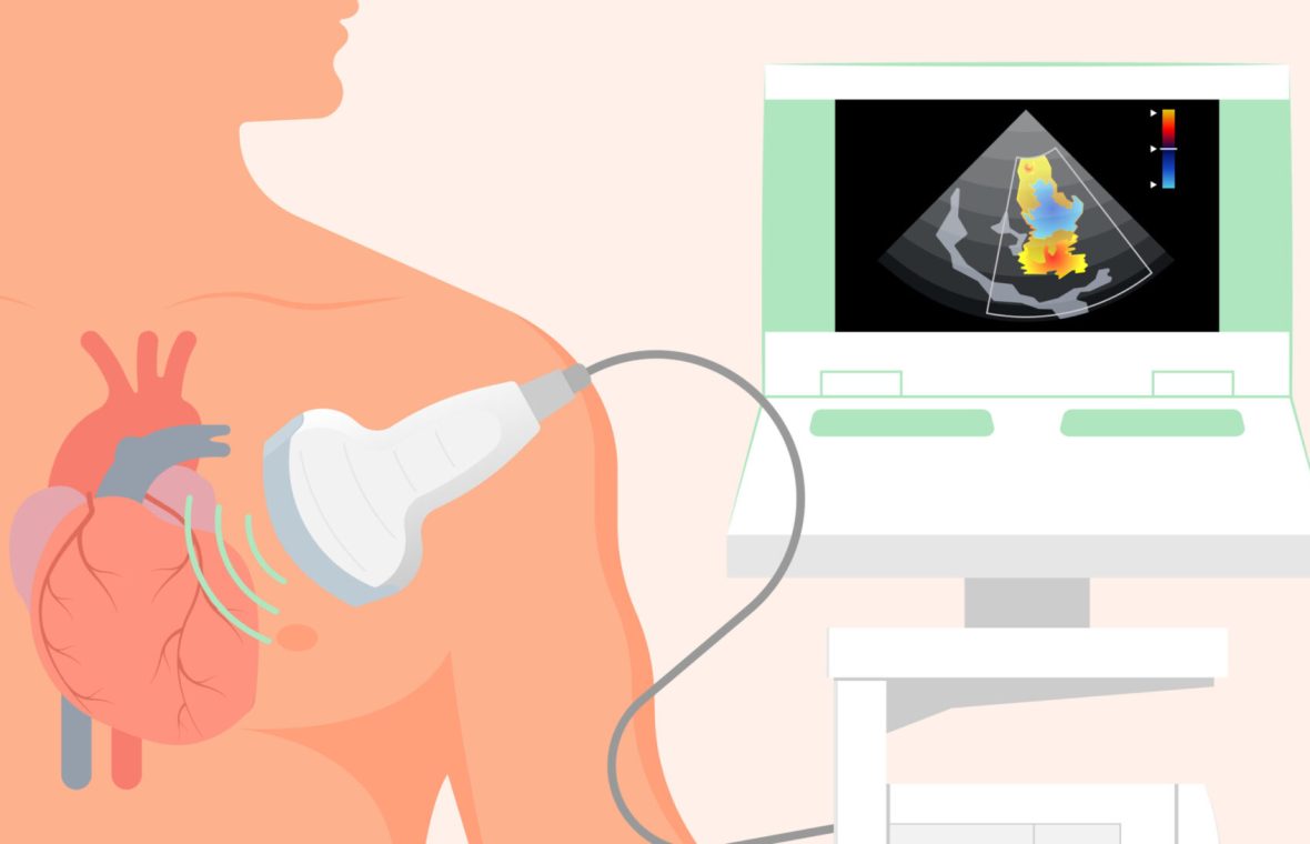 Nu este necesară o pregătire specială pentru ecografia cardiacă, poate fi efectuată în orice moment al zilei, nu doare și nu are niciun risc. Foto: Shutterstock