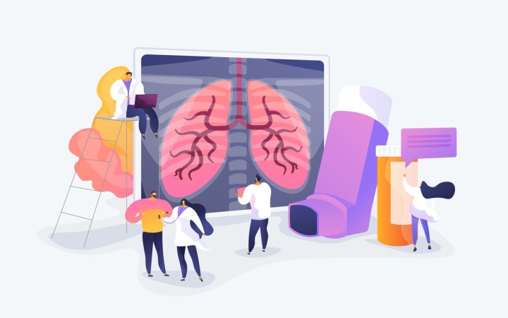 bpoc simptome tratament exercitii dieta barbat la medic, radiografie pulmonara, tratament inhalator