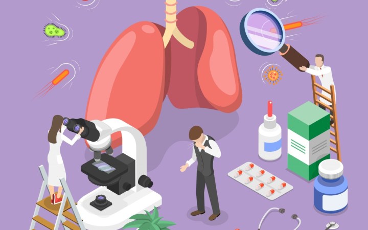 tuberculoza simptome diagnostic tratament si complicatii. plamani inspectati de medic si pacient care tuseste