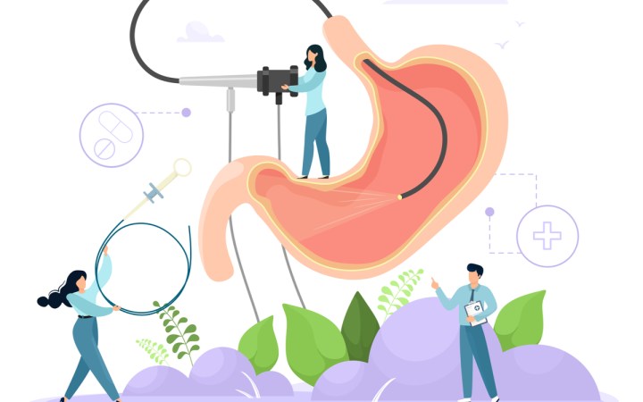 endoscopie digestiva pregatire durata complicatii. desenul unui stomac in timpul unei endoscopii digestive superioare realizate de un medic