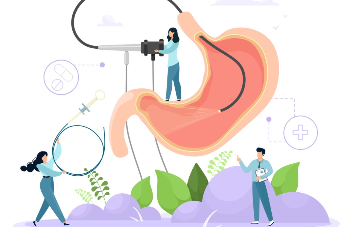 endoscopie digestiva pregatire durata complicatii. desenul unui stomac in timpul unei endoscopii digestive superioare realizate de un medic