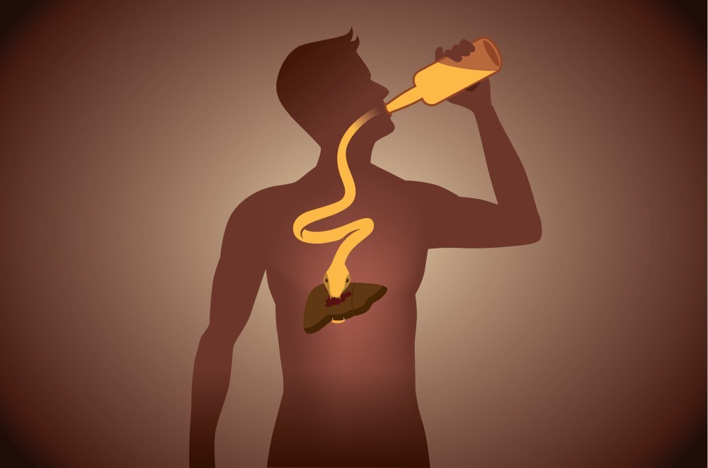 varice esofagiene de ce apar cum se trateaza. barbat care bea alcool si isi afecteaza ficatul