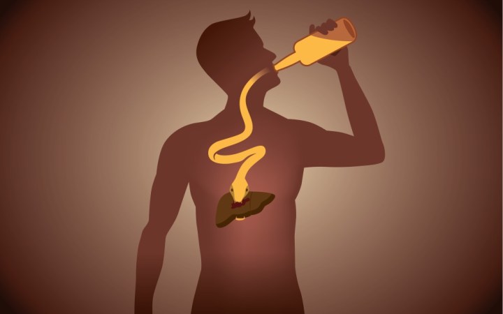 varice esofagiene de ce apar cum se trateaza. barbat care bea alcool si isi afecteaza ficatul