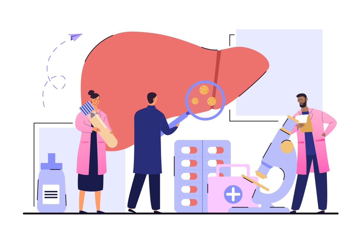 medici care analizeaza un ficat afectat de hepatita C