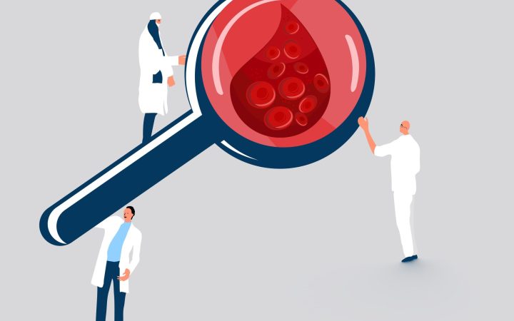 medici care se uită prin lupă la coagularea sângelui