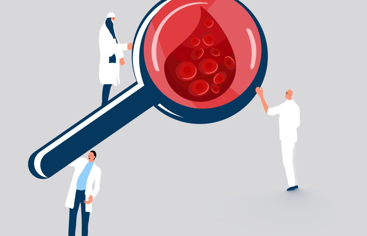 medici care se uită prin lupă la coagularea sângelui