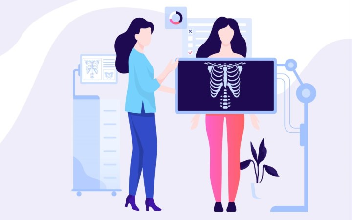 radiatii ionizante radiografie ct petct femeie la radiografie
