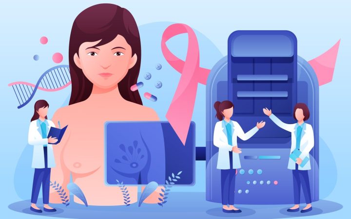 screeningul cancerului mamar de la 40 de ani. femeie care face mamografie