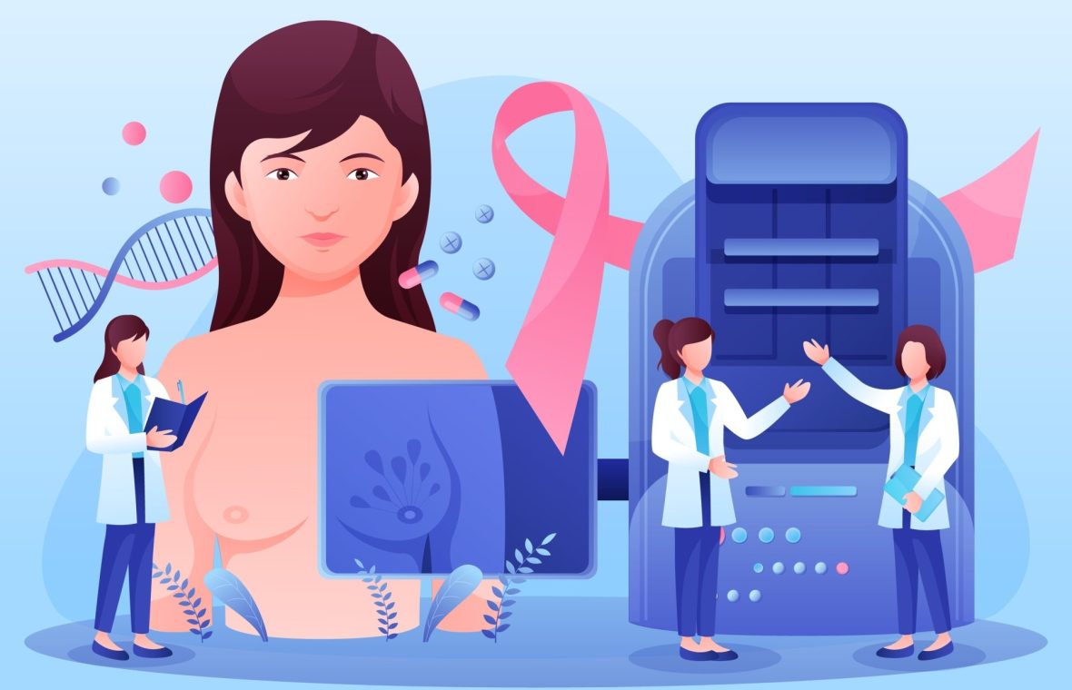 screeningul cancerului mamar de la 40 de ani. femeie care face mamografie