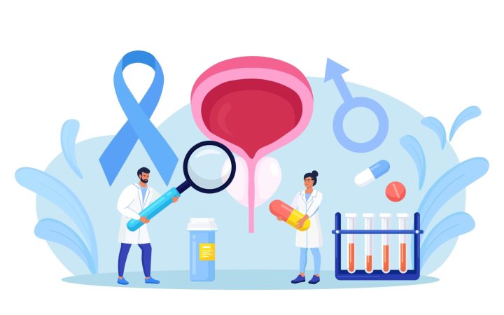 cancerul de prostata