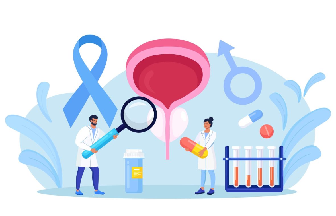 cancerul de prostata
