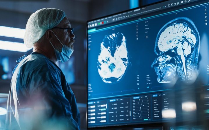 doctor analizând imaginile obținute cu un rmn pentru a vizualiza creierul îmbătrânit prematur de pandemie