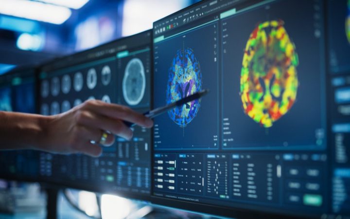 doctor indică tumori cerebrale pe un CT cerebral
