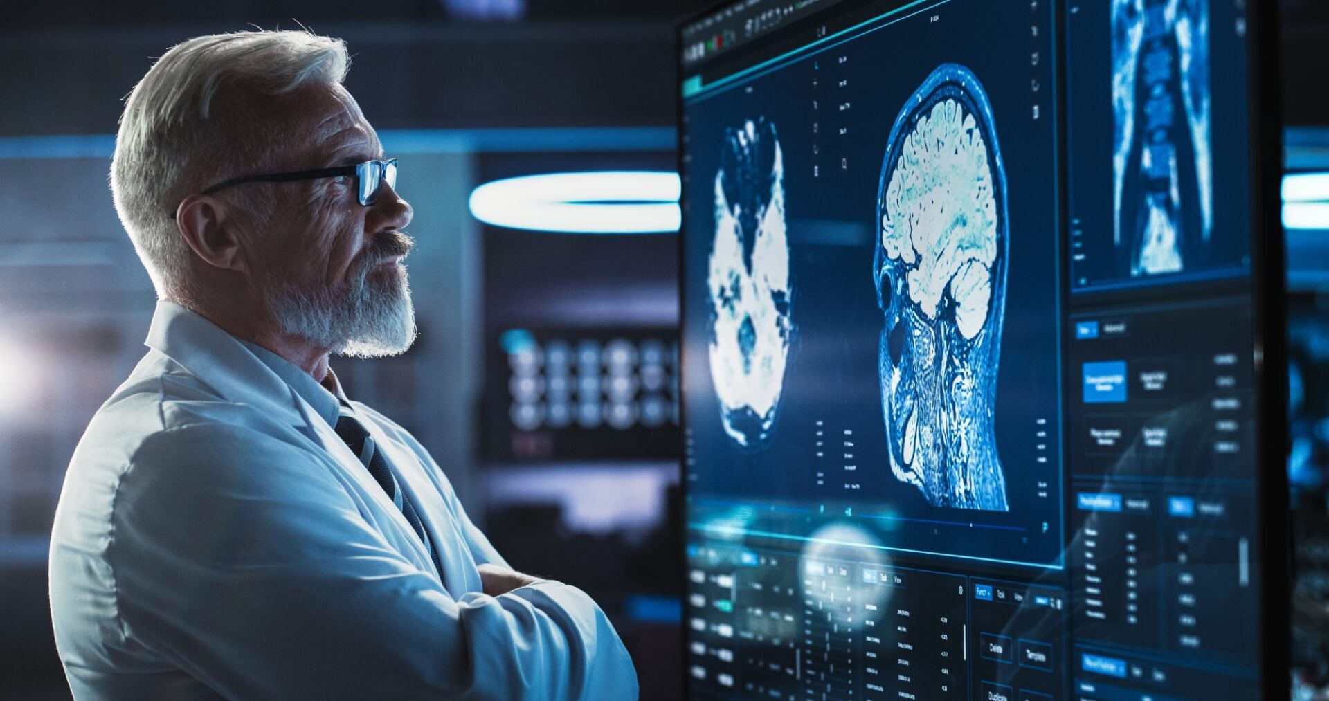 doctor bărbat în vârstă se uită la imagini cu rmn cerebral