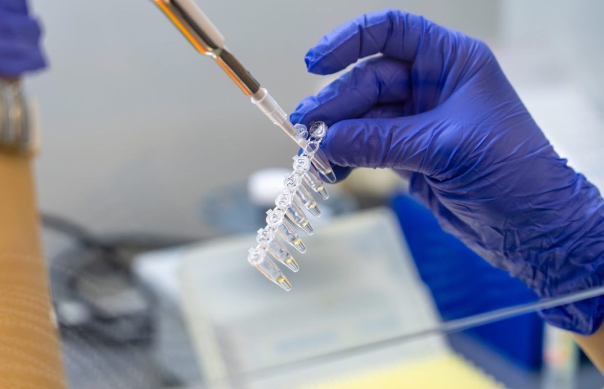 testare genetică în laborator