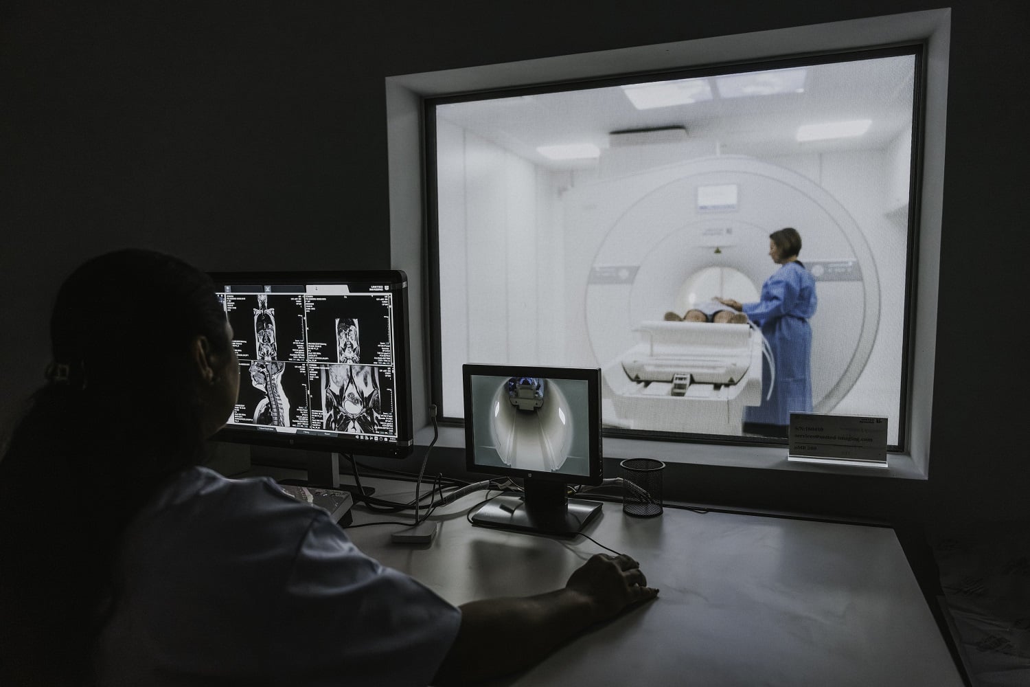 CT-ul pulmonar low-dose: cum depistăm cancerul pulmonar din stadiu incipient