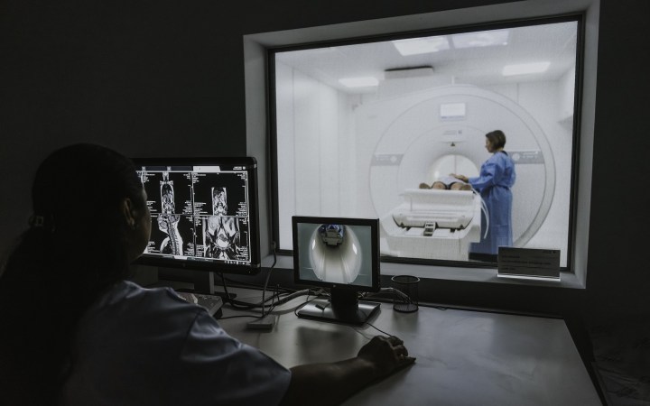 CT-ul pulmonar low-dose: cum depistăm cancerul pulmonar din stadiu incipient