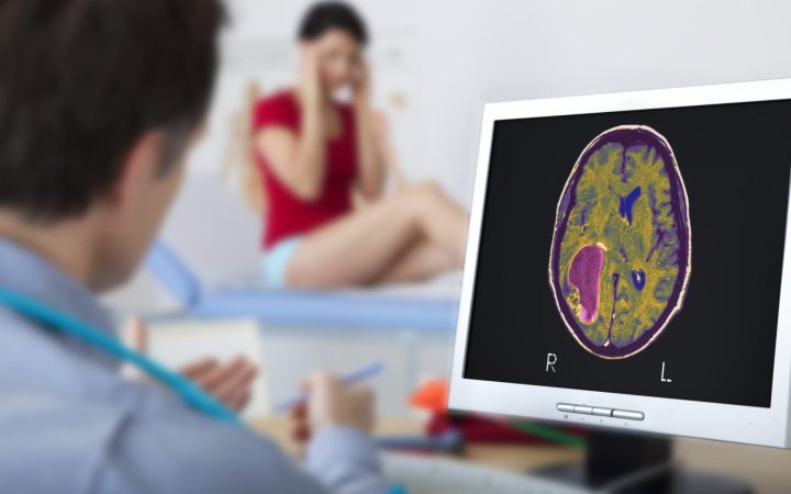 femeie de vârstă mijlocie la neurolog face o investigație a creierului pentru a evalua riscul bolii Alzheimer