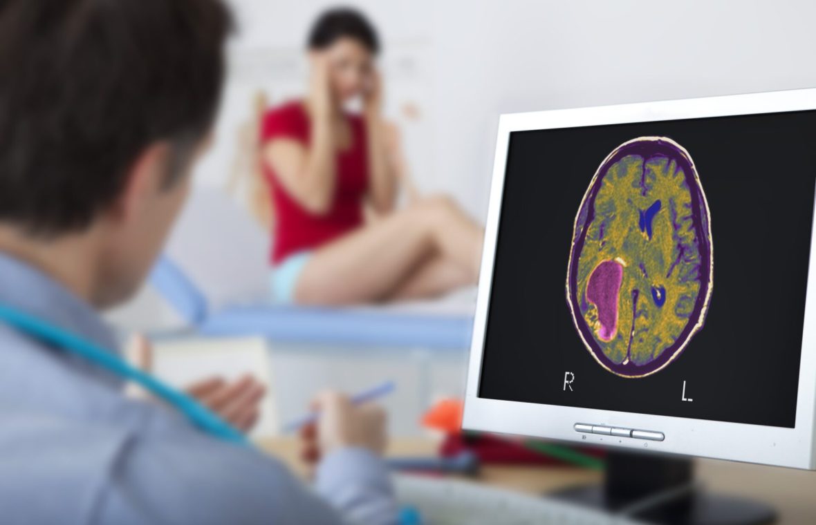 femeie de vârstă mijlocie la neurolog face o investigație a creierului pentru a evalua riscul bolii Alzheimer