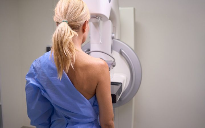 femeie care face o mamografie pentru a depista din timp cancerul de sân