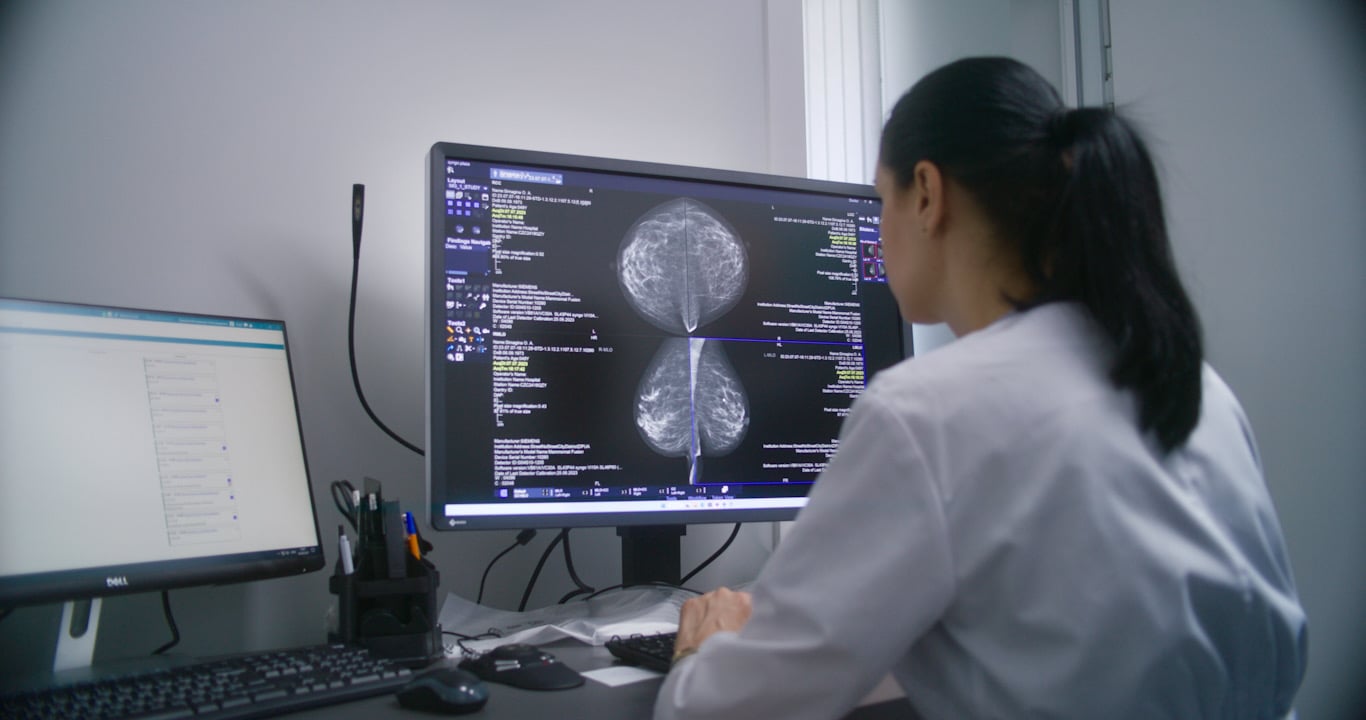 Inteligența artificială, inclusă oficial în screeningul cancerului mamar. Mamografiile vor estima și riscul de boală pentru următorii cinci ani