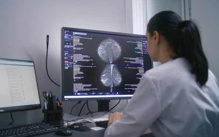 Medic interpretează o mamografie