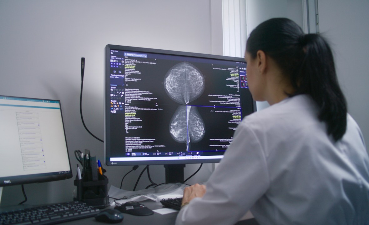 Medic interpretează o mamografie