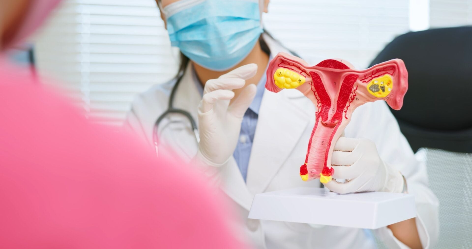 Denumirea „Sindromul ovarelor polichistice” nu va mai exista. De ce vechiul nume putea întârzia diagnosticul
